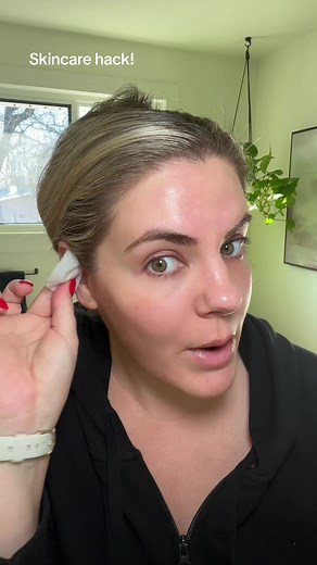 Ear Blackhead Removal Skincare Hack