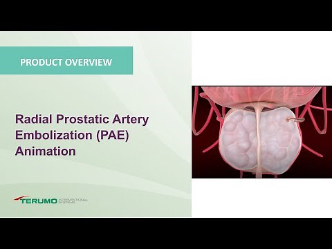 Radial Prostatic Artery Embolization (PAE) Animation | Terumo Interventional Systems