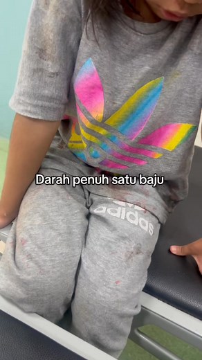 Anak bertuah no 3 Aku tengah live shopee dia mengadu cakap Dia masukkan bintang gelang tu dalam hidung lepastu dia sedut Dan mende tu ke dalam Aku dah cuak dia korek hidung dia sampai berdarah ye Terus g hospital xray tak nampak apa pon Lepastu pagi keluar dengan darah dengan lendir Hidung dia luka Sebesar mainan tu boleh masuk dlm hidung dia #fypchallenge #fypシ゚viralシfypシ゚ | Amatul Zahidi