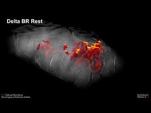 Perfusion fMRI of finger tapping (FT), brushing (BR) and rest at 7T