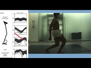 Gait Analysis Patterns in Diplegic Cerebral Palsy