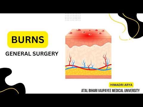 Burns Explained: Types, First Aid & Physiotherapy Recovery #physicaltherapy #physiohub