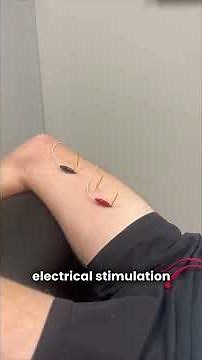 Non-surgical treatment for Hip Labral Tear #labrumteartreatment #physiotherapy #physicaltherapy