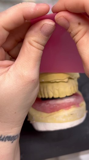 Enhance Your Smile with Denture Shades | Shade PW4 | Denture Tech