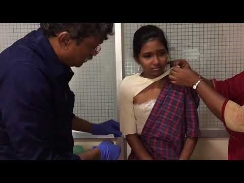 Ergonomic treatment of proximal humeral fractures