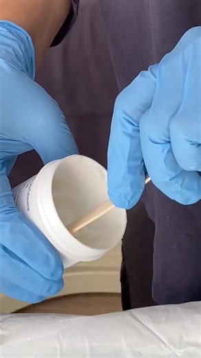 Check out this close up video of our Fractional CO2 Laser treatment - our most advanced skin treatment for ultimate results! Why do we love it?⁠ 👋🏻 Reduces pigmentation⁠ 😇 Reduces fine lines and wrinkles⁠ 🏋🏻‍♀️ Tightens skin⁠ 🧬 Promotes a smoother skin texture and collagen production⁠ ⁠ This treatment uses a fractional carbon dioxide laser, this laser passes pulses of light down through to the deeper layers of the skin, causing controlled damage to skin cells, triggering the skin’s natural