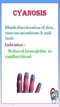 TIPS: 10 GENERAL EXAMINATION - PALLOR, ICTERUS, CYANOSIS, CLUBBING, LYMPHADENOPATHY, EDEMA