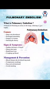 Pulmonary Embolism made easy | Medical Talks