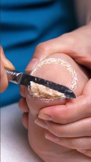 Extreme Foot Texture Clean | ASMR
