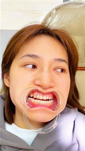 Ela Foi ao PIOR Dentista ! 😱😂 #incrivel #bizarro #dentist