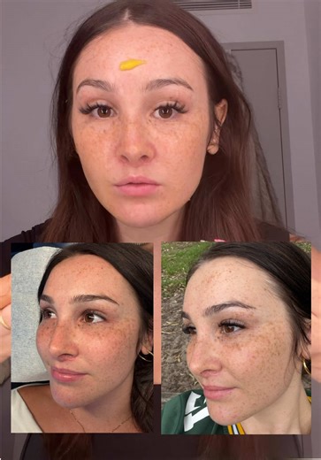 Boost Your Skincare Routine with Arencia Vitamin C Shot