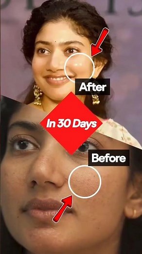 Pimple varama erukaraku edhan simple hack therinjukonga 😌