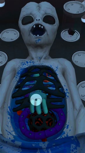 I become a surgeon 😈 day #5 #shorts #ytshorts #shortsfeed #surgeonsimulator