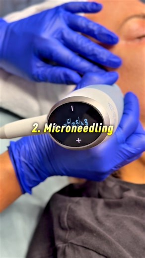 We were excited to try Exion – the multi platform that can combines ✅ Deep collagen-boosting radiofrequency ✅ Skin-renewing microneedles ✅ Precision fractional tech ✅ Reduced pain with AI optimization. ONE treatment for the results of FOUR? …all in one session. We have been a fan of radiofrequency microneedling for skin rejuvenation and deep acne scars. Exion’s 4 Power Treatments in 1 Device: 1️⃣ Radiofrequency (RF) Energy What it does: Heats deep skin layers to boost collagen & elastin. Exion’s