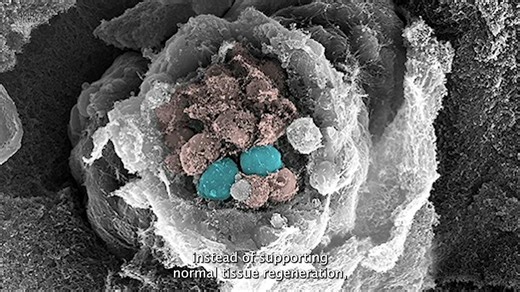 #WorldCancerDay | #Cancer takes many forms, and understanding how normal cells become cancerous is key to making progress. Investigator Linheng Li shares how Institute scientists study cancer stem cells and the cellular disruptions that drive diseases like #leukemia and #coloncancer. 🔗 Explore how foundational #research at the Institute is helping envision a cancer-free future: https://bit.ly/49UqmxI | Stowers Institute for Medical Research