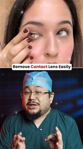 How to Remove Contact Lens Correctly✅ #contactlenses