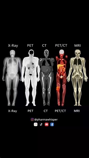 PharmaWhisper on Instagram: "Medical Imaging Modalities: See the Body Like Never Before Explore how different medical imaging techniques visualize the human body—from basic structure to advanced metabolic activity. This clean, high-impact visual comparison helps medical, pharmacy, and radiology students quickly understand what each modality shows and when it’s used. ✨ Why this infographic is valuable: ✔️ Side-by-side comparison of X-Ray, PET, CT, PET/CT & MRI ✔️ Shows structural vs functional im
