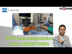 Stiff knee manipulation under ANAESTHESIA‪@DrdebashishChanda‬