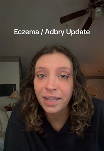 I underestimated my second maintenance dose of adbry…might blame it on the nap #lifewitheczema #eczemaawareness #eczemajourney #adbry #eczema