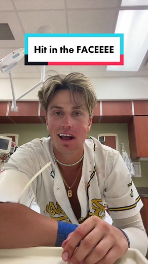 I can’t let Taylor Swift see me like this… #baseballboys #ouch | jackson olson hit in face