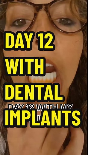 Dental Implant Care Routine: Tips for Cleaning and Healing