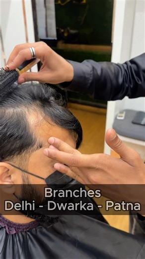 Premium Clipping Hair Patch | Easy to Use Hair Patch for Men #hairpatch #shortsfeed