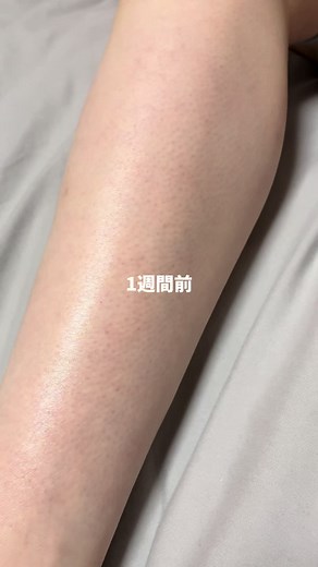 毛穴に効くレチノールクリーム試してみた