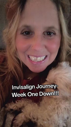 Week 1 Invisalign journey ✅... Can't wait to see how Week 2 Tray fits!! will it be tight??? 😬😬 stay tuned to find out!!! One week down , 2 years to go 🤦🏼‍♀️🤣 #invisalignsmile #invisalign #theinvisalignchronicals