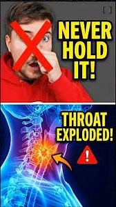 Why You Should NEVER Hold Your Sneeze 🤧💥 #shorts