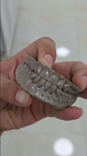 upper and lower denture | dental denture | full denture asmr | asmr