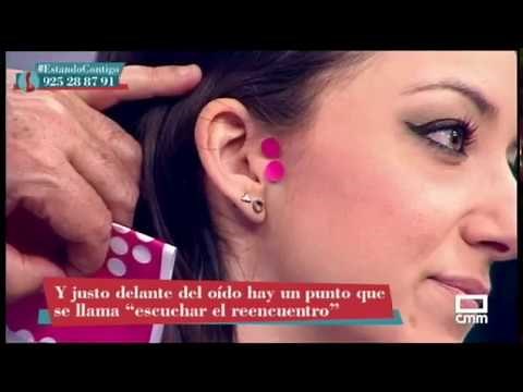 Acupuncture for hearing loss