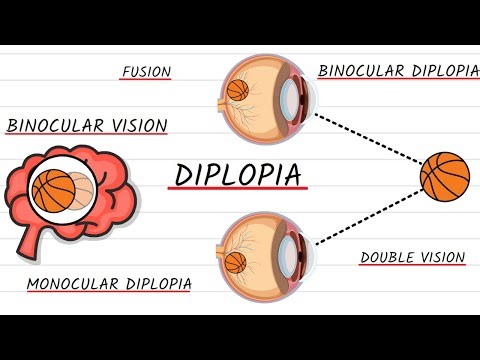 Why Do My Eyes See Double? Double Vision Explained