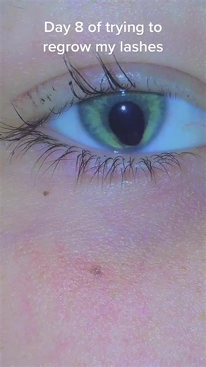 Day 8 of regrowing my lashes #trichotillomania #plucking #fyp #foryou #eyelashes