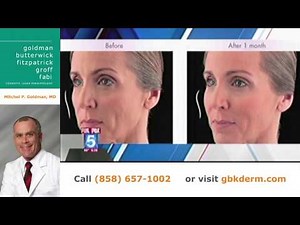 San Diego Voluma Filler FDA Approved for Cheek Enhancement | Dr. Goldman