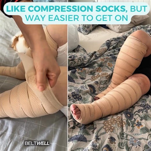 Same benefits as compression socks but fits way better & is easier to put on and off. ✅ Easy to put on ✅ Actually fit big, swollen legs ✅ Relief in just hours "Within 2 hours, my pain was 80% less. Walking felt normal again — and after 3 months, I’d lost weight, felt younger, and could finally enjoy life again." No wonder 100,000 people are raving about them. 👉 Right now: 60% OFF But hurry — this offer ends tonight | Beltwell