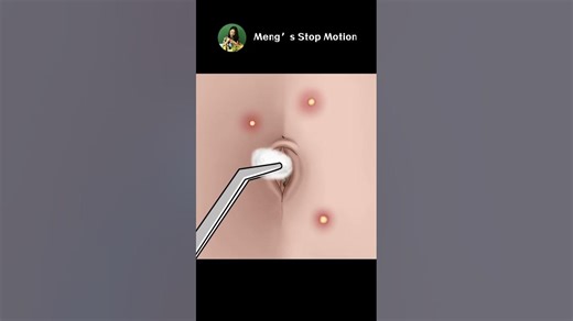 130K views · 467 reactions | How DIRTY could a belly button be?! ASMR Belly Button Cleaning Animation #fyp #reelsfb | Meng's Stop Motion | Facebook
