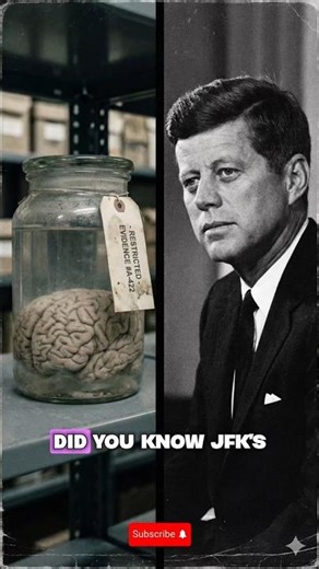 Wait, JFK’s Brain is Officially MISSING? 🧠❓