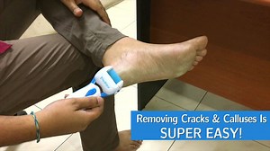 493K views · 2.1K reactions | MEGA CHRISTMAS OFFER! Get smooth feet...