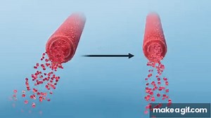Blood Flow & Vascular Resistance on Make a GIF