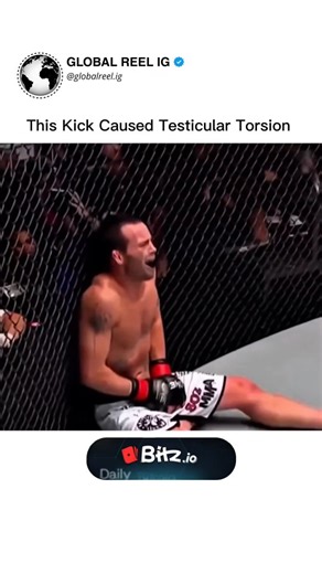Global Reel IG ™ on Instagram: "Testicular torsion is a medical emergency that occurs when the spermatic cord, which supplies blood to the testicle, becomes twisted. This twisting cuts off the testicle’s blood supply, leading to sudden and severe pain and swelling in the scrotum. It most commonly affects adolescent males but can occur at any age. The main symptoms include intense scrotal pain, swelling, abdominal discomfort, nausea, and vomiting. The affected testicle may also appear higher than