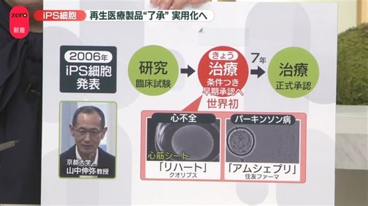 【解説】iPS細胞“製品”世界初の実用化へ　「早期承認」を了承…今後7年かけ有効性・安全性を確認（日テレNEWS NNN）