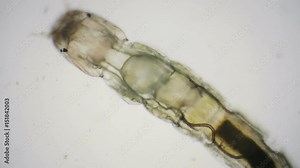 Larvae of chironomids or non-biting midges through a microscope