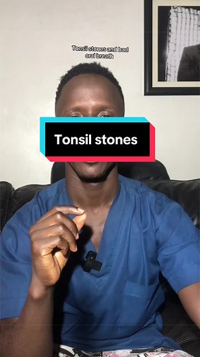 Tonsil stones and bad oral breath: causes, symptoms, treatment