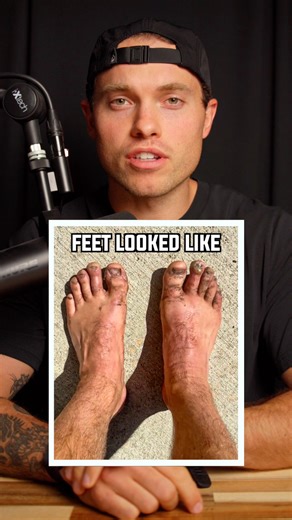 The Best Socks for Running