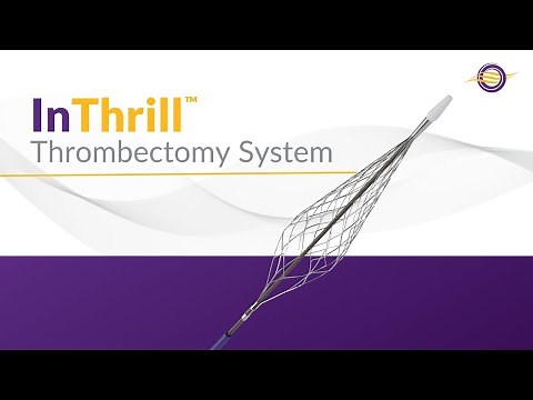 InThrill Thrombectomy System