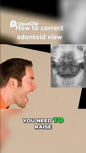 How To Correct The Odontoid Xray View.