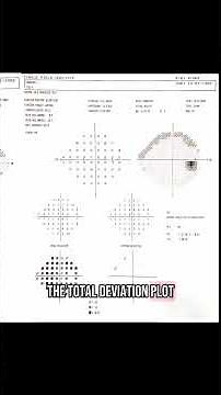1234 How to - interpreting a visual field plot
