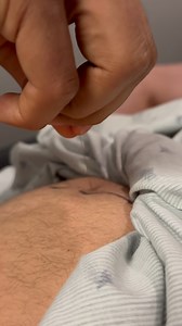 🏆 Dry needling the piriformis targets deep gluteal tension that can compress the sciatic nerve and limit mobility. It helps reduce pain, improve hip function, and get you moving again. 🏃🏾‍♀️🏋🏻‍♂️🏌🏽‍♂️ #DryNeedling #PiriformisRelief #SciaticaHelp #HipMobility #ChicagoChiropractor | Dr_kyleross