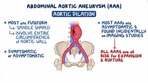 Video: Abdominal aortic aneurysm: Clinical sciences - Video Explanation! | Osmosis | Osmosis