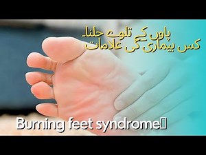 Burning feet syndrome. پاوں کے تلوے جلنا۔ کس بیماری کی علامات